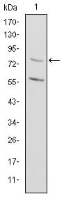 MTHFR Antibody (clone 5D3)