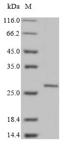 Rat USAG1 / SOSTDC1 Protein (Recombinant 10His, N-terminus + Myc, C-terminus)