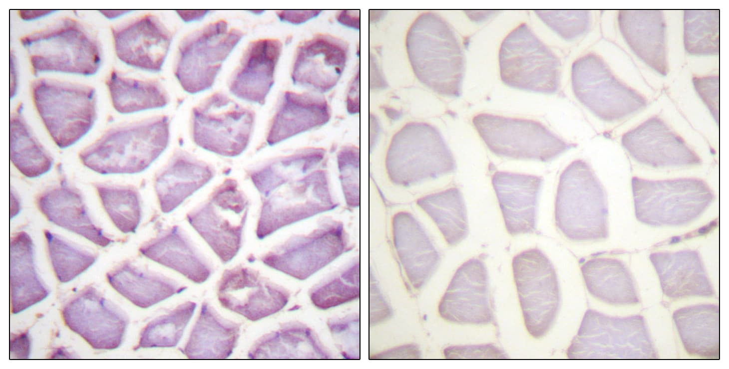 Polyclonal Rabbit anti-Human PARK2 / Parkin 2 Antibody (phospho-Ser131, IHC)