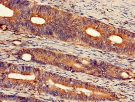 Polyclonal Rabbit anti-Human EXT2 Antibody (IHC)