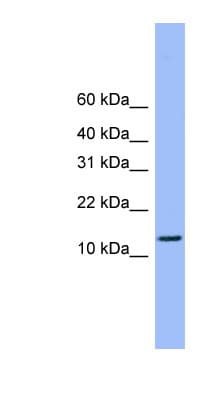 Polyclonal Rabbit anti-Human ATP5H Antibody (C-Terminus, WB)