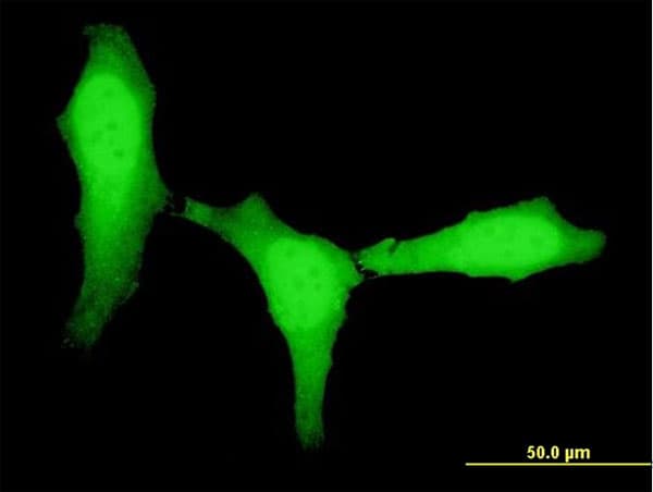 Monoclonal Mouse anti-Human ZEB1 / AREB6 Antibody (clone 4C4, IF, WB)