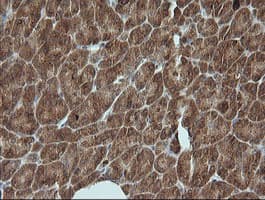 PIK3R5 Antibody (clone OTI2C6)