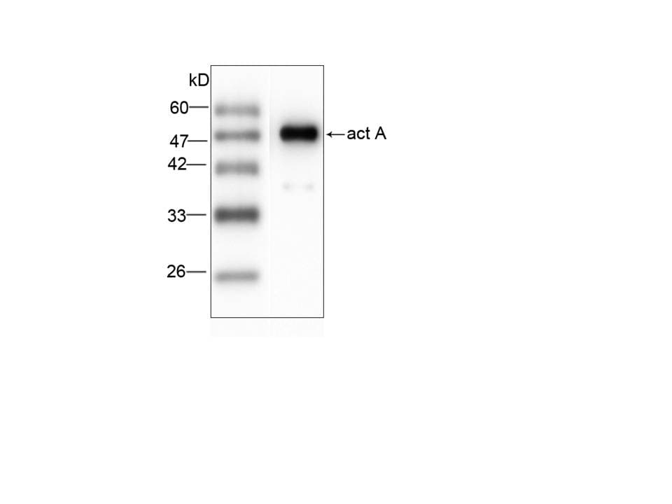 Listeria monocytogenes ActA Antibody (aa117-278)