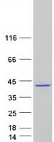 Human TBX20 Protein (Recombinant Myc-DDK (Flag))