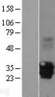 MPZL2 Protein (Over-Expression Lysate Myc-DDK (Flag))