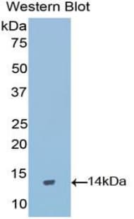 GNRH Antibody (aa25-92)