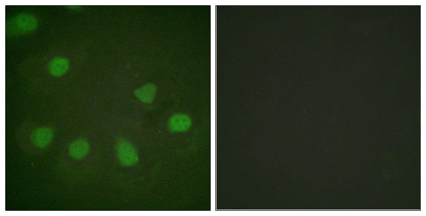 RB1 / Retinoblastoma / RB Antibody