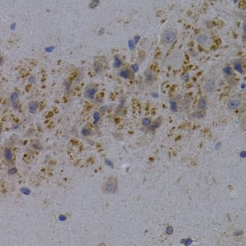 IHC-plus™ PPP1R1B / DARPP-32 Antibody