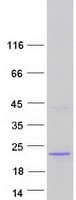 Human C14orf184 Protein (Recombinant Myc-DDK (Flag))