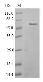 Mouse ACLP / AEBP1 Protein (Recombinant 6His-SUMO, N-terminus)