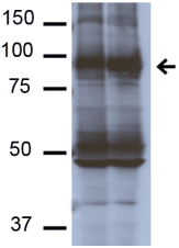 Monoclonal Mouse anti-Rat SCNN1A / ENaC Alpha Antibody (clone 16E4, WB)