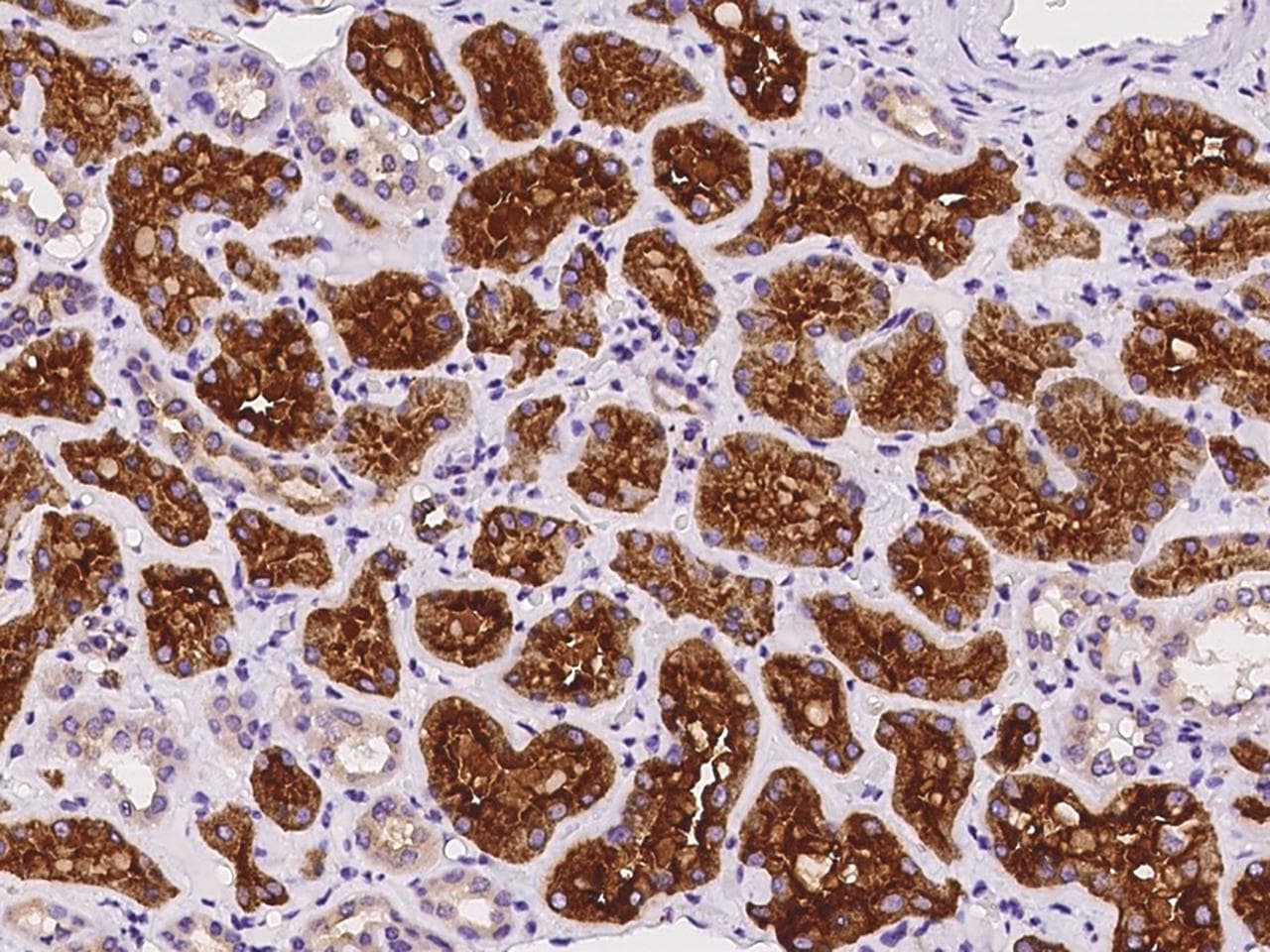 Polyclonal Rabbit anti-Human ATP6V1B2 Antibody (IHC, IF)