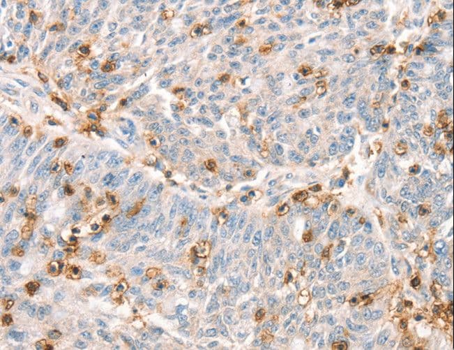 SPN / CD43 Antibody