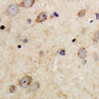 Polyclonal Rabbit anti-Human MAP2 Antibody (N-Terminus, IHC, WB)
