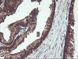 PSMB7 Antibody (aa58-277, clone OTI1D1, Carrier-free)