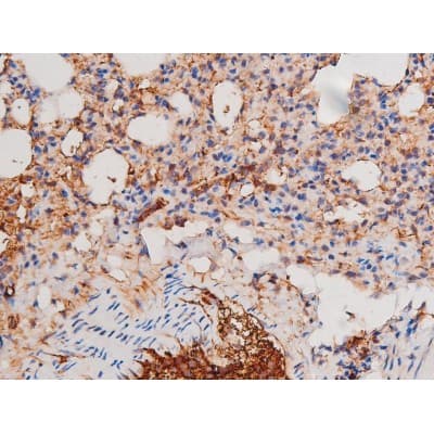 ADD1 / Adducin Alpha Antibody (phospho-Ser726)