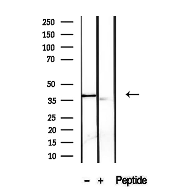PRSS8 / Prostasin Antibody