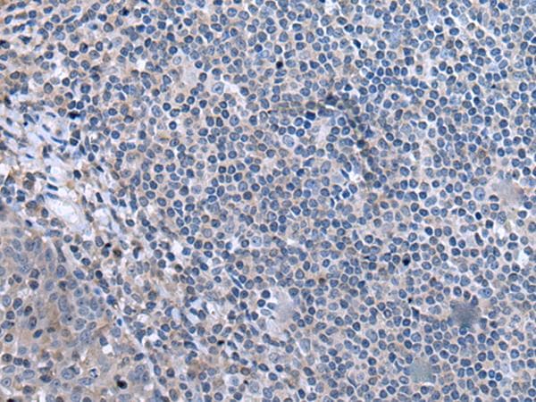 CCK / Cholecystokinin Antibody
