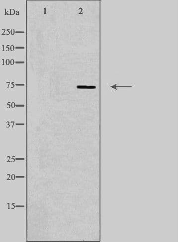 SLC5A2 / SGLT2 Antibody