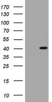 CCND1 / Cyclin D1 Antibody (clone OTI1G2)