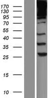 SPTBN1 / ELF Protein (Over-Expression Lysate Myc-DDK (Flag))