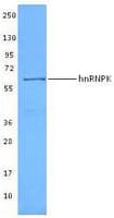 IHC-plus™ HNRNPK / hnRNP K Antibody (clone F45 P9 C7)