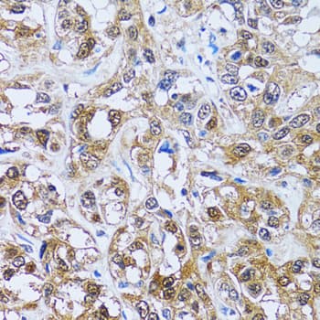 Polyclonal Rabbit anti-Human IMPA1 / IMP Antibody (IHC, IF, WB)