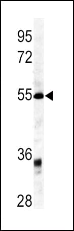 GDF6 / BMP13 Antibody (aa326-353)