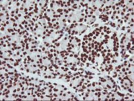 NONO / P54NRB Antibody (clone OTI3F8)