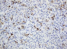 TP / Thymidine Phosphorylase Antibody (clone OTI7B4)