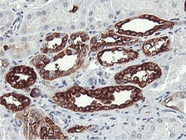 PFKP Antibody (clone OTI3G8, Carrier-free)