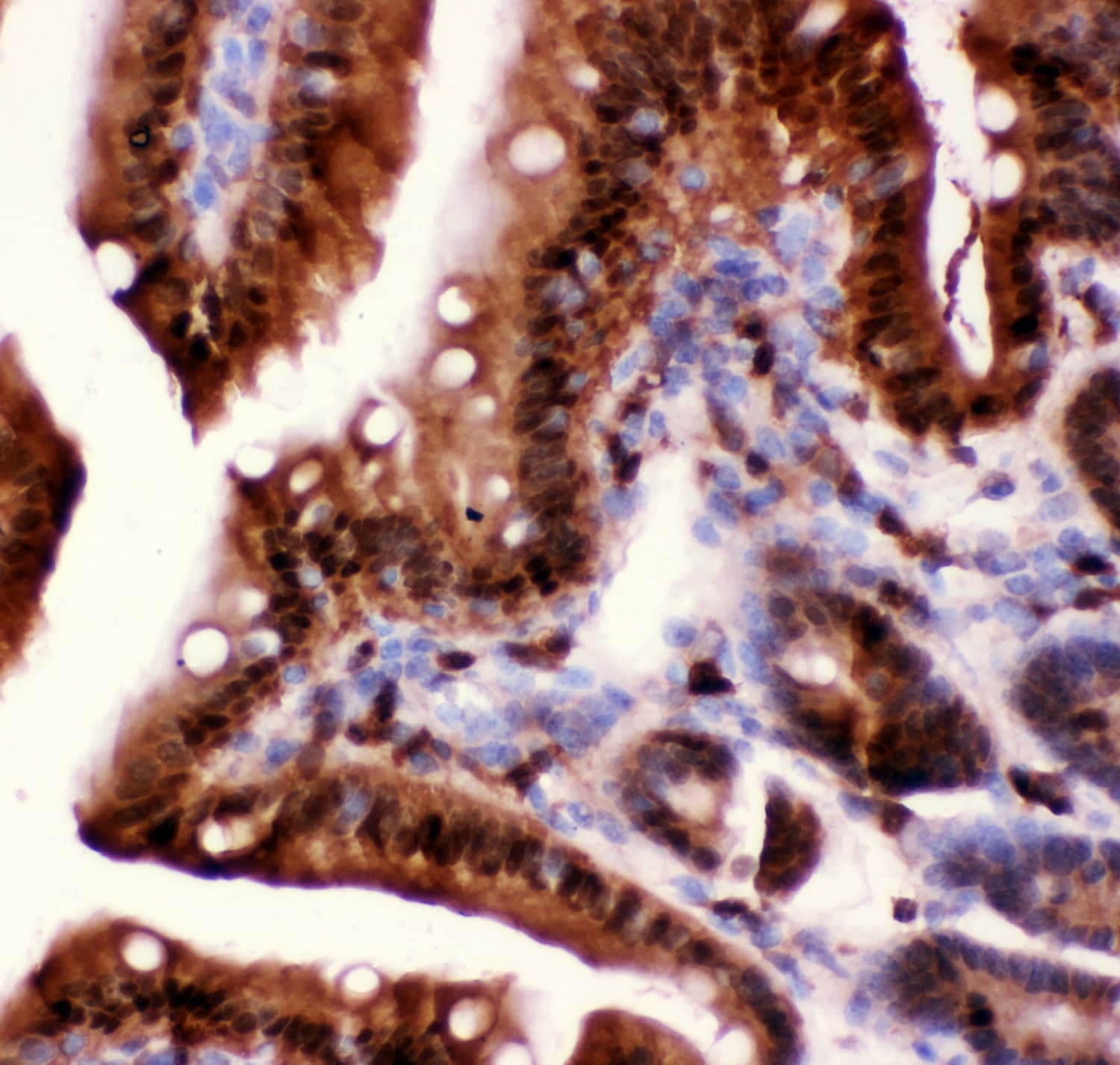 CASP3 / Caspase 3 Antibody (aa67-175)