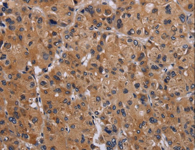 Polyclonal Rabbit anti-Human GNAS Antibody (IHC, WB)