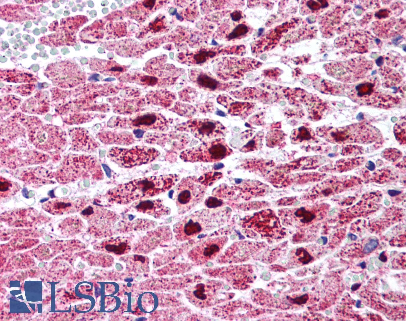 IHC-plus™ PPARG / PPAR Gamma Antibody