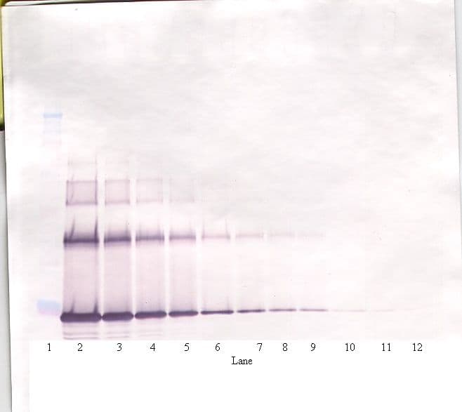 PathPlus™ Polyclonal Rabbit anti-Human IL6 / Interleukin 6 Antibody (IHC, WB)