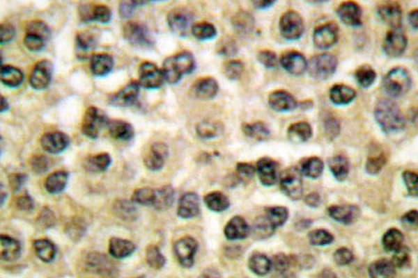 RAN Antibody (Glu202)