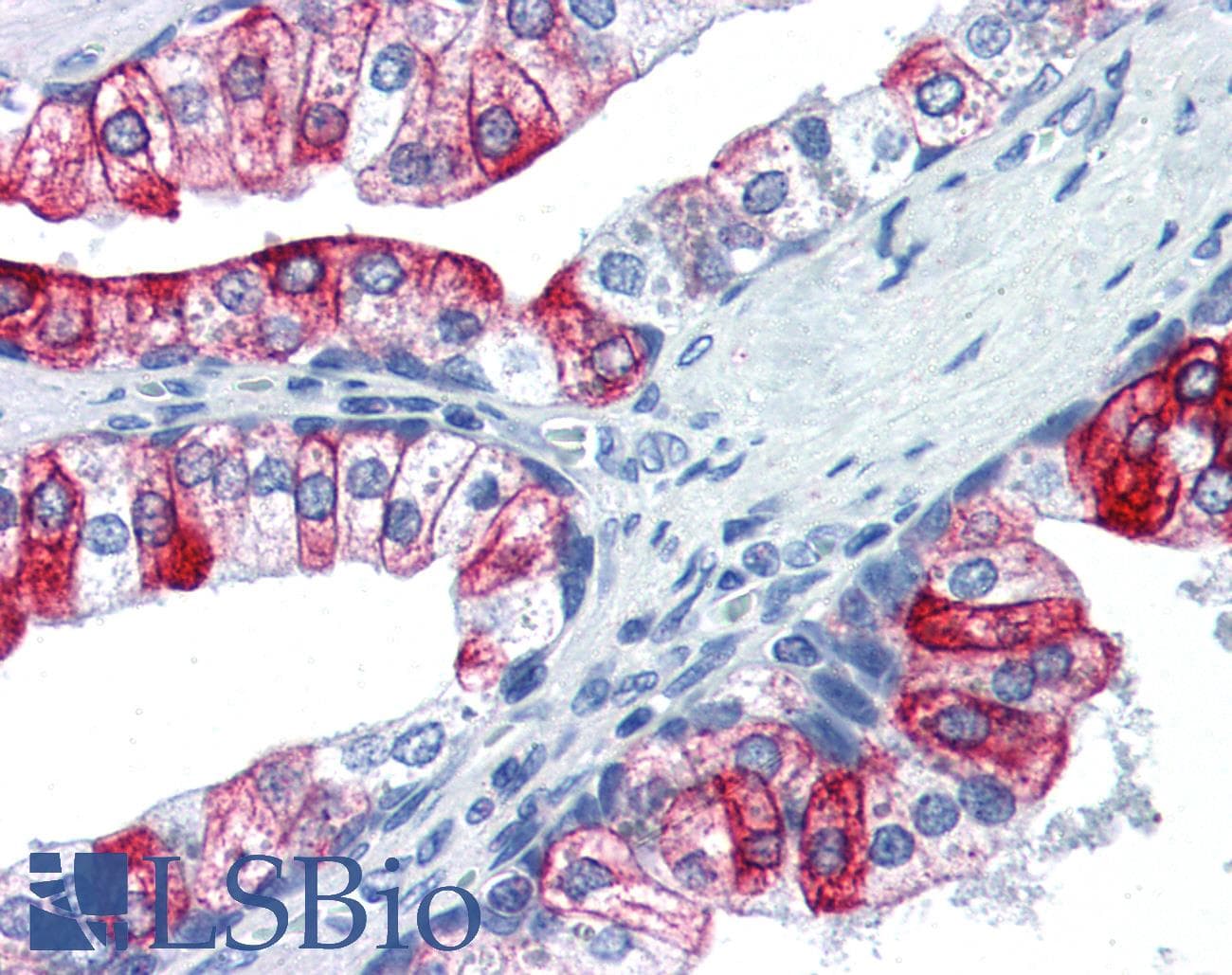 IHC-plus™ PMEL / SILV / gp100 Antibody (C-Terminus)