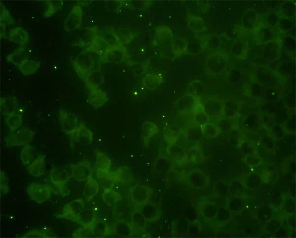 RAP2B Antibody (clone 4F12-3C6)