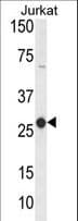 NK1 / CD160 Antibody (aa56-82)