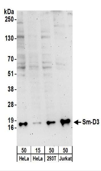 IHC-plus™ SNRPD3 Antibody (aa76-126)