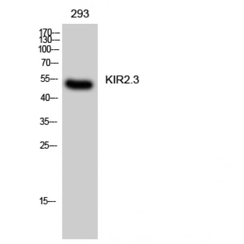 Polyclonal Rabbit anti-Human KCNJ4 / Kir2.3 Antibody (220-300 aa, Internal, WB)