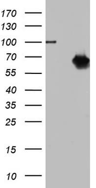 Monoclonal Mouse anti-Human NR2C1 Antibody (clone OTI4C7, aa1-237, WB)