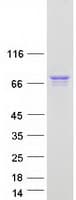 Human ARX Protein (Recombinant Myc-DDK (Flag))