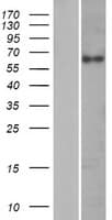 KRT76 / Keratin 76 Protein (Over-Expression Lysate Myc-DDK (Flag))