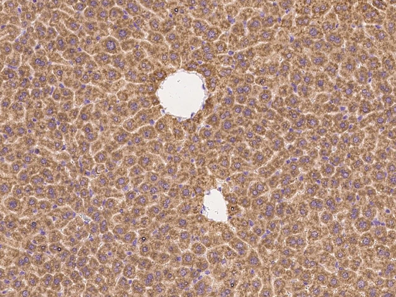 NRP1 / Neuropilin 1 Antibody