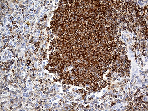 Monoclonal Mouse anti-Human RPSA / Laminin Receptor Antibody (clone OTI1G3, aa2-295, IHC, WB)