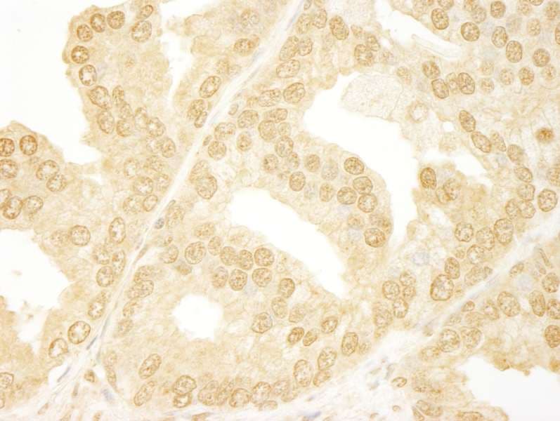 ANKRD17 Antibody (aa1550-1600)