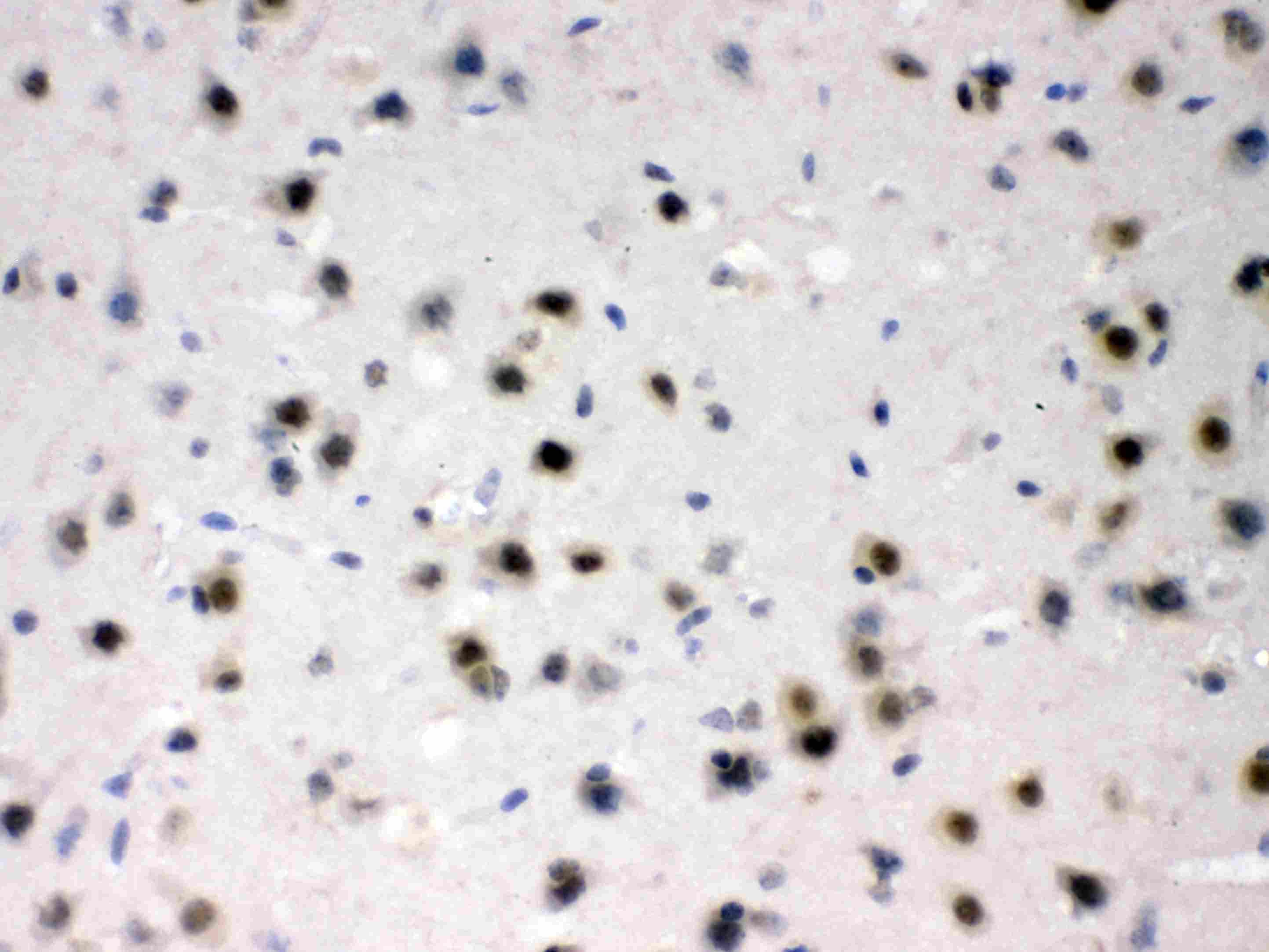 AZIN2 / Antizyme Inhibitor 2 Antibody
