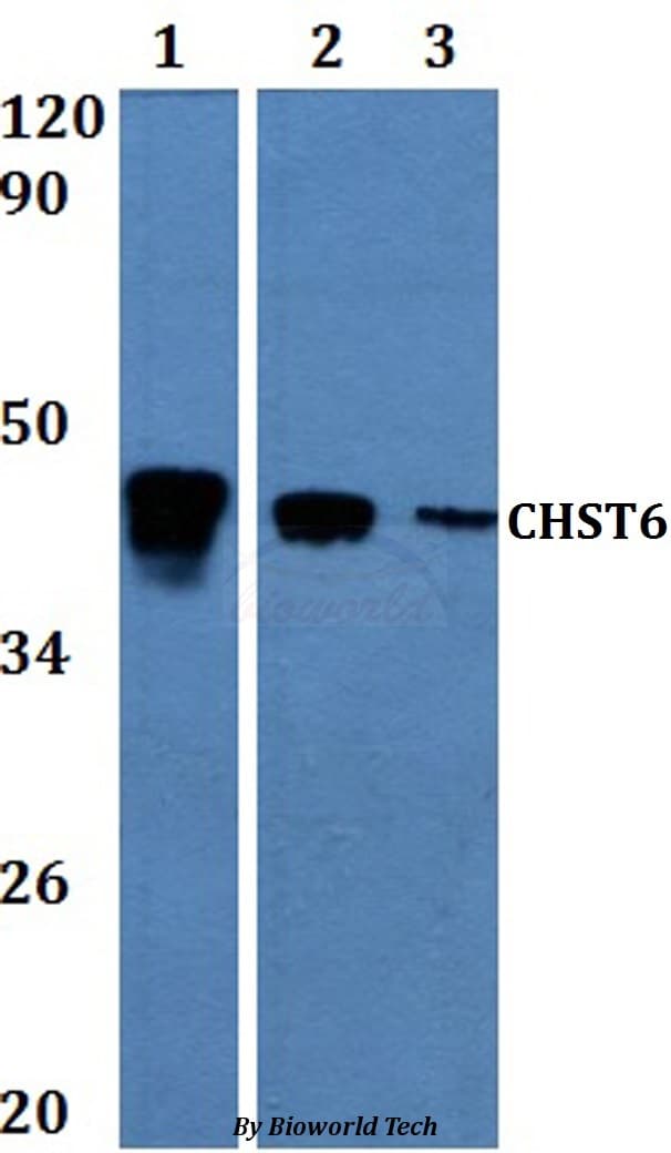 Polyclonal Rabbit anti-Human CHST6 Antibody (WB)